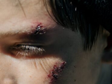 Personal Injury Law
