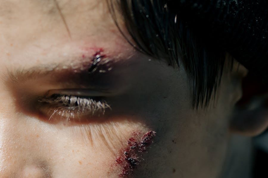 Personal Injury Law